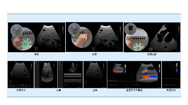 超聲模擬實訓係統 教師機