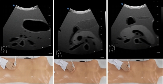 超聲模擬實訓係統 單機版（男）