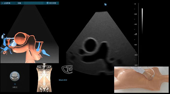 超聲模擬實訓係統 單機版（女）
